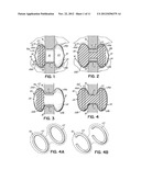 EXPANDABLE INTERSPINOUS PROCESS SPACER WITH LATERAL SUPPORT AND METHOD FOR     IMPLANTATION diagram and image