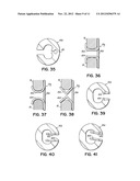 EXPANDABLE INTERSPINOUS PROCESS SPACER WITH LATERAL SUPPORT AND METHOD FOR     IMPLANTATION diagram and image