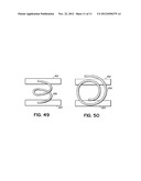 EXPANDABLE INTERSPINOUS PROCESS SPACER WITH LATERAL SUPPORT AND METHOD FOR     IMPLANTATION diagram and image