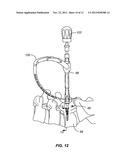 HINGED BONE SCREW WITH A TULIP BULB CONNECTOR IN A SPINAL FIXATION     ASSEMBLY diagram and image