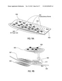 Array of Joined Microtransponders for Implantation diagram and image