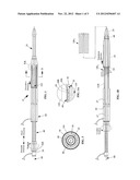 Apparatus And Method for Proximal-to-Distal Endoluminal Stent Deployment diagram and image