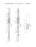 Apparatus And Method for Proximal-to-Distal Endoluminal Stent Deployment diagram and image