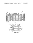 Stent Graft Assembly and Method diagram and image