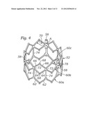 ENCAPSULATED HEART VALVE diagram and image