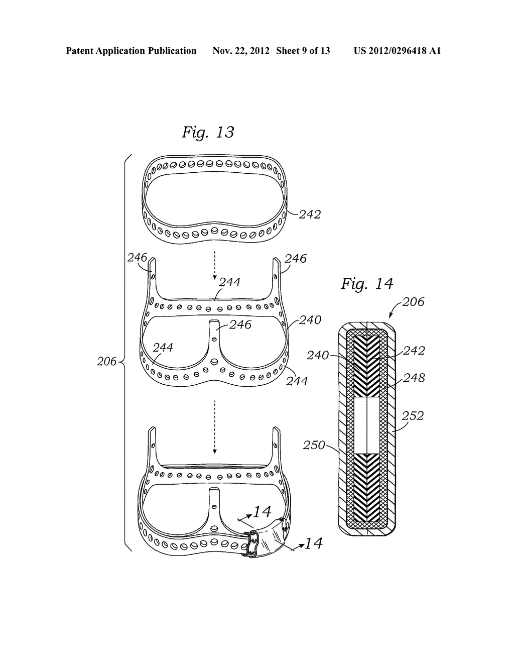 ENCAPSULATED HEART VALVE - diagram, schematic, and image 10