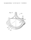 ENCAPSULATED HEART VALVE diagram and image