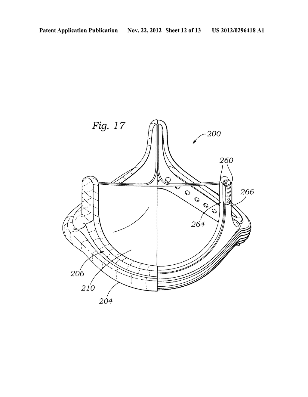 ENCAPSULATED HEART VALVE - diagram, schematic, and image 13