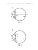 METHOD FOR DESIGNING, EVALUATING AND OPTIMIZING OPHTHALMIC LENSES AND     LASER VISION CORRECTION diagram and image