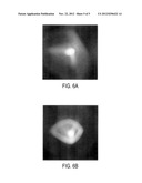 METHOD FOR DESIGNING, EVALUATING AND OPTIMIZING OPHTHALMIC LENSES AND     LASER VISION CORRECTION diagram and image