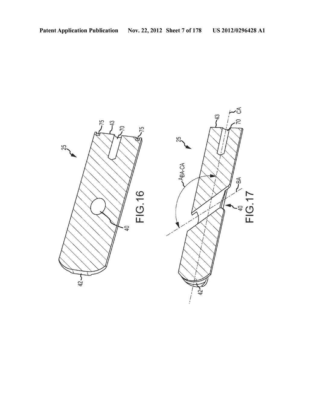 SYSTEMS FOR AND METHODS OF FUSING A SACROILIAC JOINT - diagram, schematic, and image 08