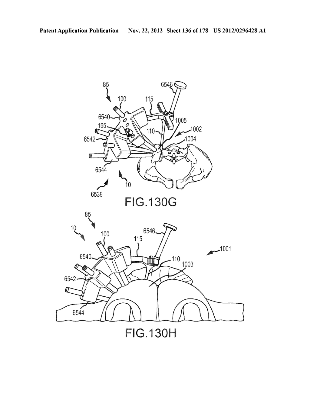 SYSTEMS FOR AND METHODS OF FUSING A SACROILIAC JOINT - diagram, schematic, and image 137