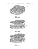 Prosthetic Intervertebral Disc Implants diagram and image