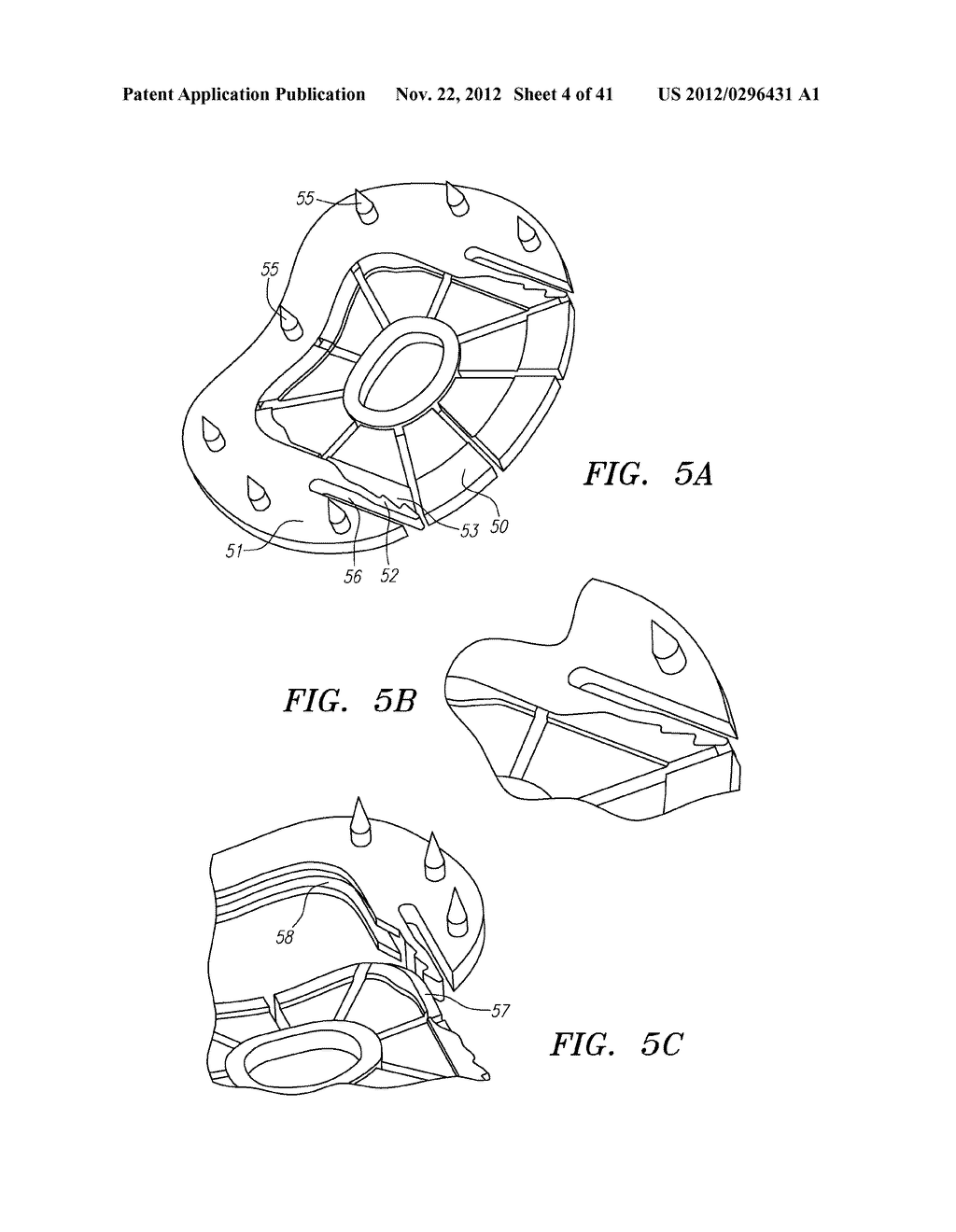 Prosthetic Intervertebral Disc Implants - diagram, schematic, and image 05