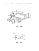 Prosthetic Intervertebral Disc Implants diagram and image