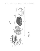 Prosthetic Intervertebral Disc Implants diagram and image