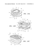 Prosthetic Intervertebral Disc Implants diagram and image