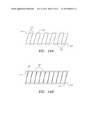 Prosthetic Intervertebral Disc Implants diagram and image