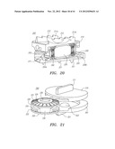 Prosthetic Intervertebral Disc Implants diagram and image