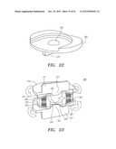 Prosthetic Intervertebral Disc Implants diagram and image