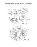 Prosthetic Intervertebral Disc Implants diagram and image