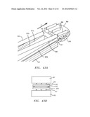 Prosthetic Intervertebral Disc Implants diagram and image