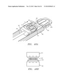 Prosthetic Intervertebral Disc Implants diagram and image