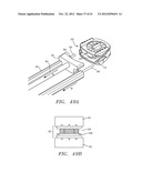 Prosthetic Intervertebral Disc Implants diagram and image