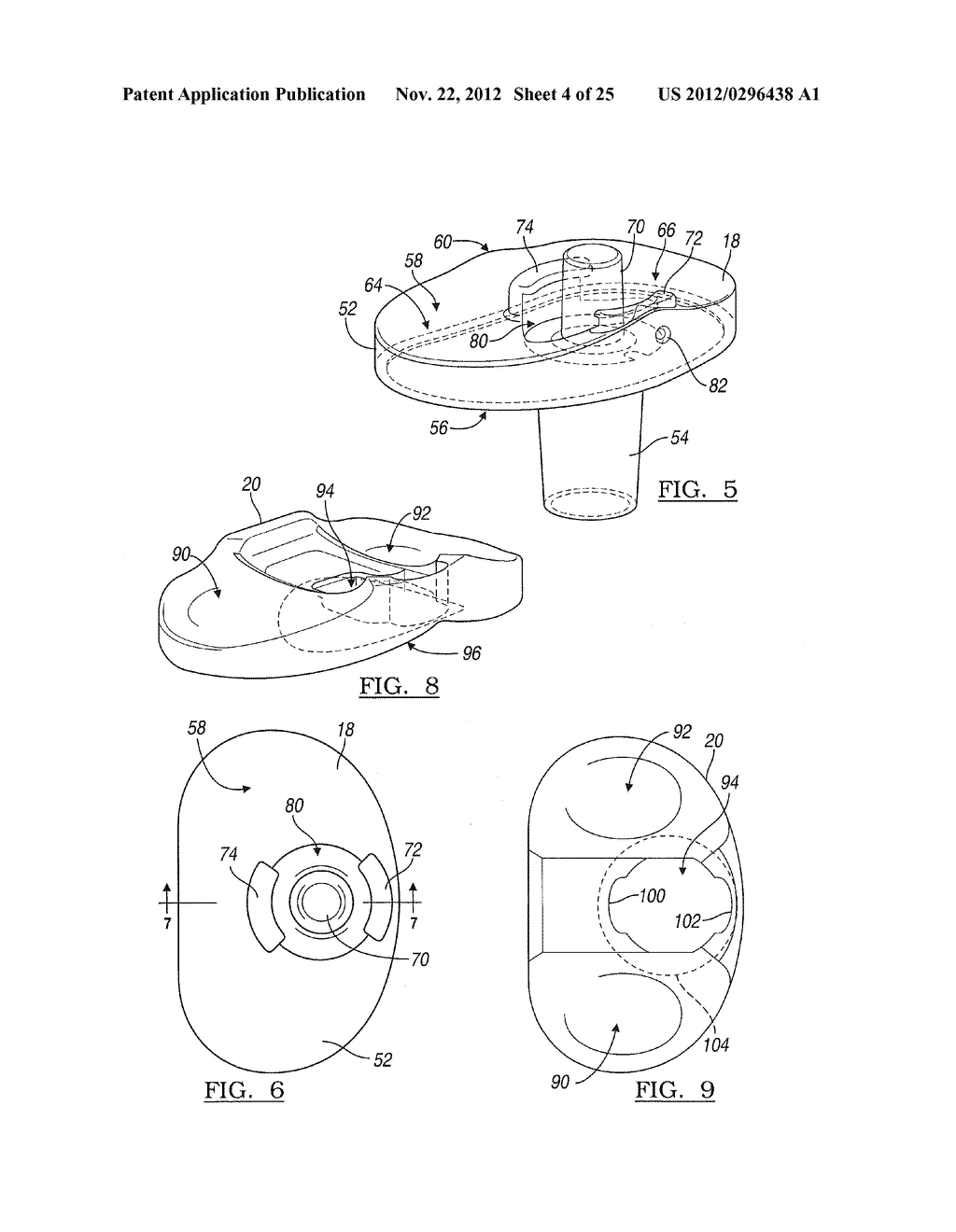 KNEE JOINT PROSTHESIS SYSTEM AND METHOD FOR IMPLANTATION - diagram, schematic, and image 05