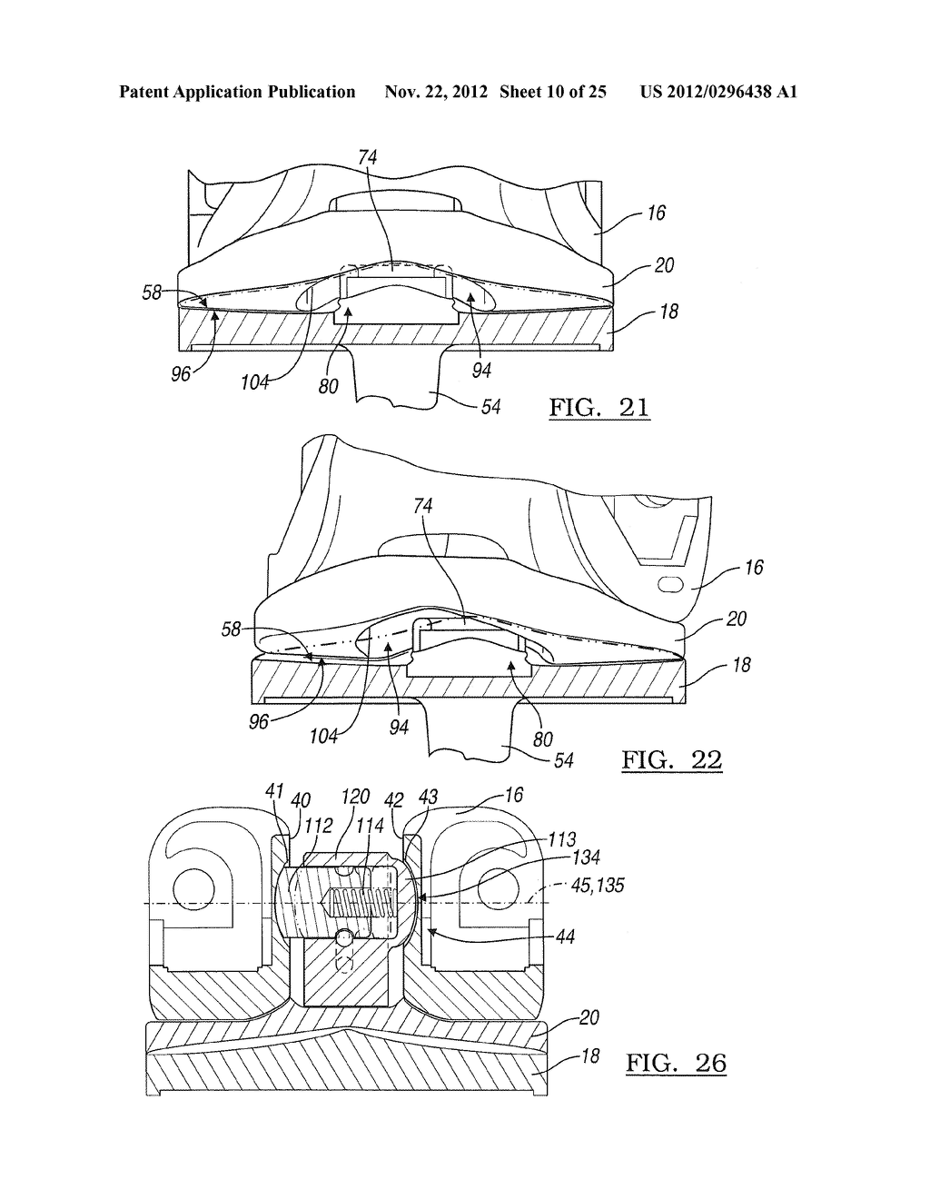 KNEE JOINT PROSTHESIS SYSTEM AND METHOD FOR IMPLANTATION - diagram, schematic, and image 11