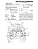 DEVICE FOR OSTEOSYNTHESIS OF THE THORACIC WALL diagram and image