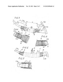 DEVICE FOR OSTEOSYNTHESIS OF THE THORACIC WALL diagram and image