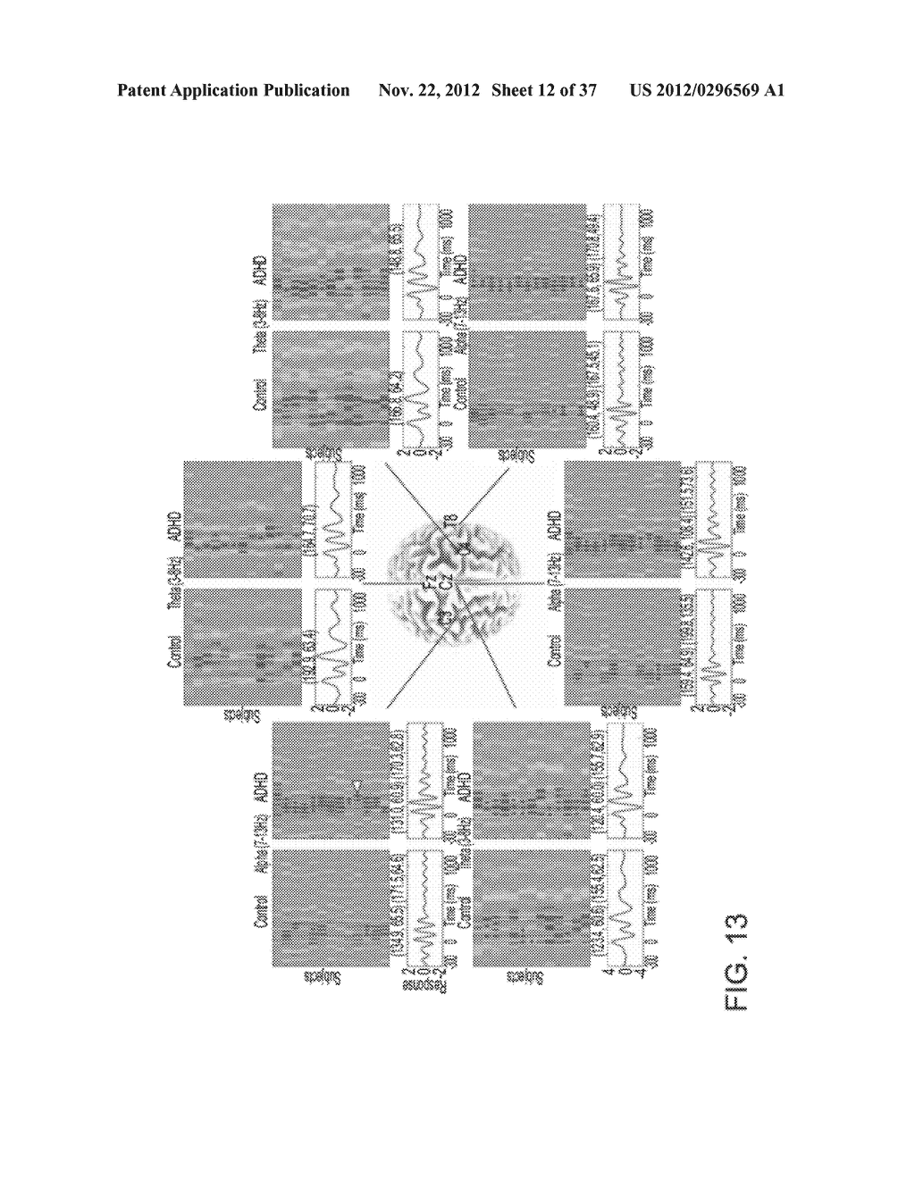 METHOD AND SYSTEM FOR WEIGHTED ANALYSIS OF NEUROPHYSIOLOGICAL DATA - diagram, schematic, and image 13