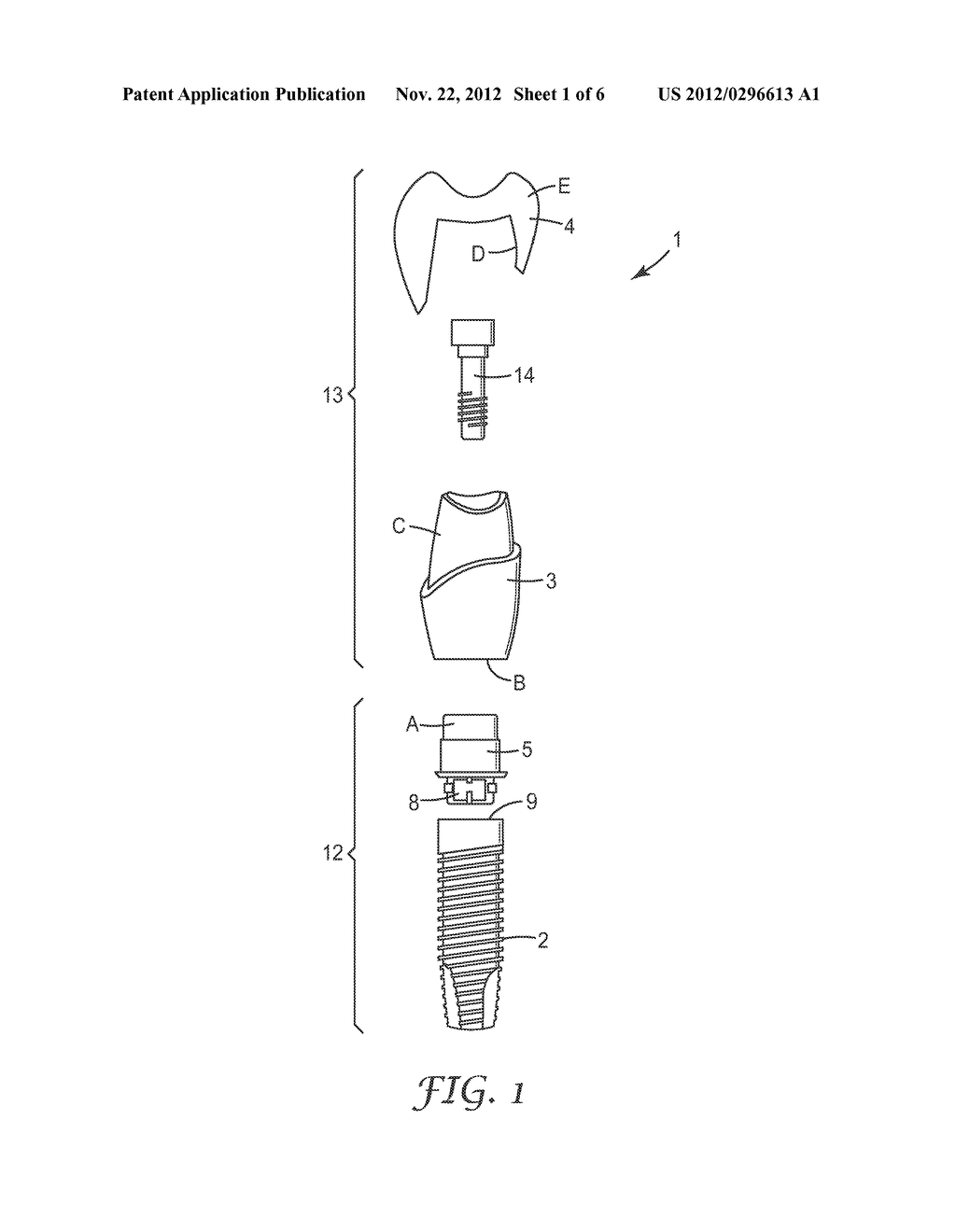 METHOD AND SYSTEM FOR DESIGNING A DENTAL RESTORATION - diagram, schematic, and image 02