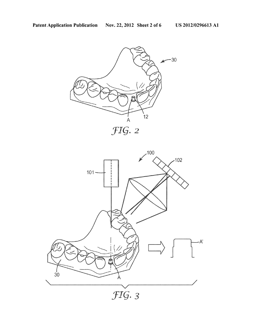 METHOD AND SYSTEM FOR DESIGNING A DENTAL RESTORATION - diagram, schematic, and image 03