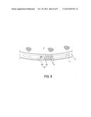 BOTTOM PERIPHERY LENGTH ADJUSTMENT MECHANISM diagram and image