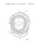 Helmet System diagram and image