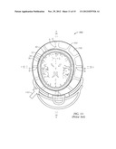 Helmet System diagram and image