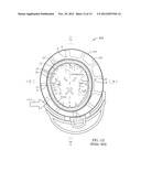 Helmet System diagram and image