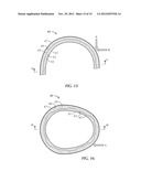 Helmet System diagram and image