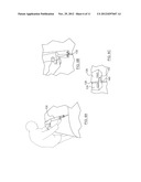 COUPLING FOR VENTILATION ASSEMBLY diagram and image