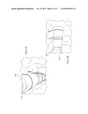 COUPLING FOR VENTILATION ASSEMBLY diagram and image