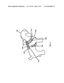 NON-CHOKING HARNESS FOR PET diagram and image