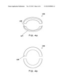 Thermal Insulation Apparatus And Method diagram and image