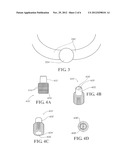 Magnet Aided Intubation Systems, Kits, and Methods diagram and image