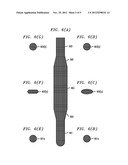 Introducer for Surgical Airway Catheters diagram and image