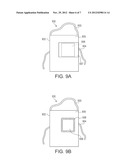 WOUND DRESSING SYSTEM diagram and image