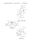 WOUND DRESSING SYSTEM diagram and image