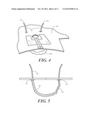 Surgical Drape Configured for Peripherally Inserted Central Catheter     Procedures diagram and image