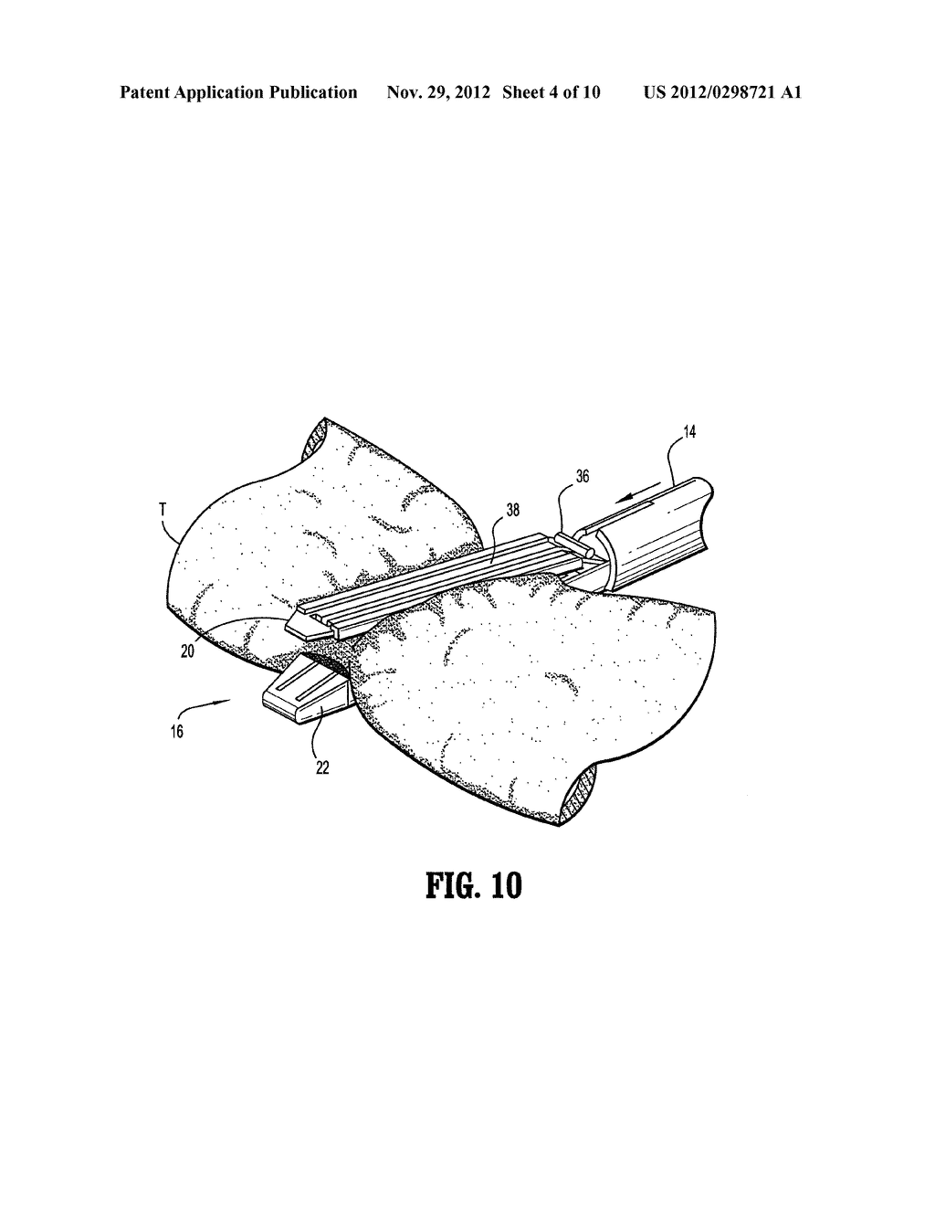 Staple Buttress Retention System - diagram, schematic, and image 05